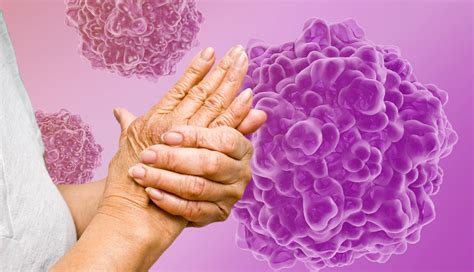 aarp free cell|What to Know About Human Parvovirus B19 .